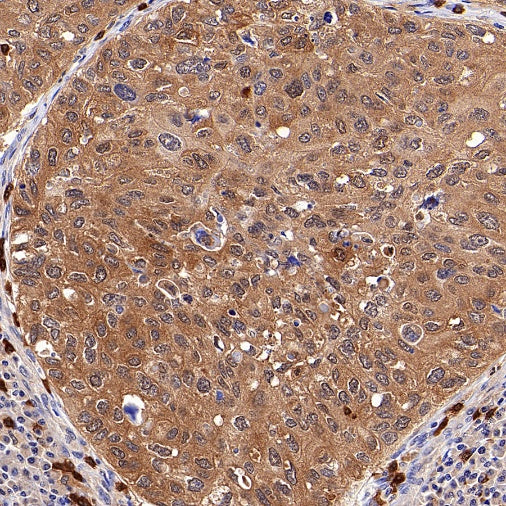 IFIH1 Recombinant Rabbit mAb (S-2413-49)