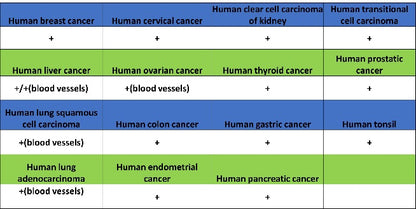 Angiotensin Converting Enzyme 1 Recombinant Rabbit mAb (SDT-2662-122)