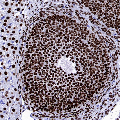 FOXL2 Recombinant Rabbit mAb (SDT-557-361)