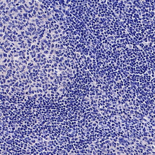 SOX11 Recombinant Mouse mAb (SDT-919-58)