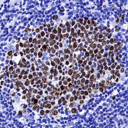 S-RMab® Ki67 Recombinant Rabbit mAb (SDT-R459)