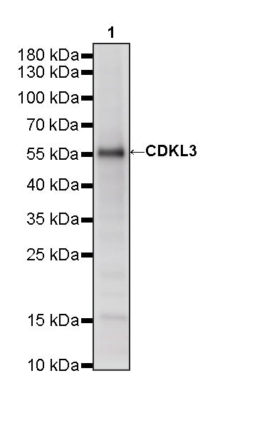 CDKL3 Recombinant Rabbit mAb (S-4356-11)