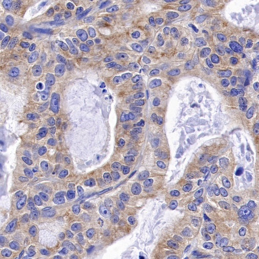 α-tubulin Rabbit Polyclonal Antibody