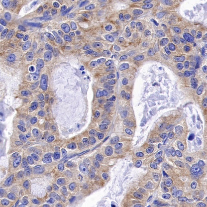 α-tubulin Rabbit Polyclonal Antibody