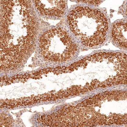 RUVBL1 Recombinant Rabbit mAb (S-1600-38)