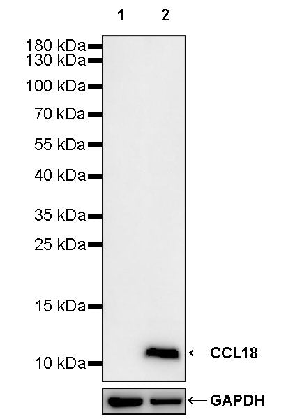 CCL18 Recombinant Rabbit mAb (S-2788-25)