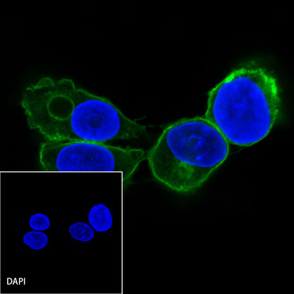 EGFR Recombinant Rabbit mAb (SDT-R110)