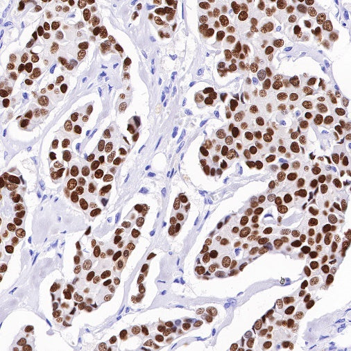 Estrogen Receptor α Recombinant Rabbit mAb (SDT-10001)