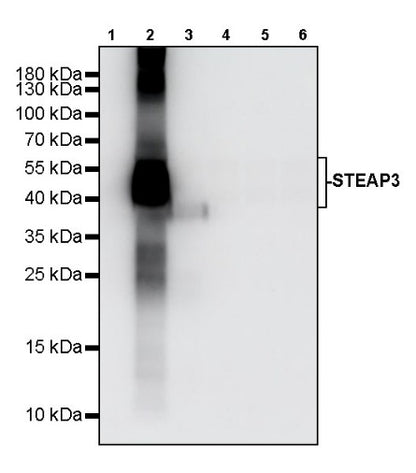 STEAP3 Recombinant Rabbit mAb (S-4466-26)