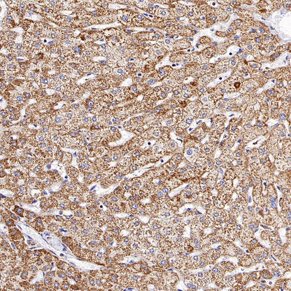 UQCRC2 Recombinant Rabbit mAb (S-1890-227)