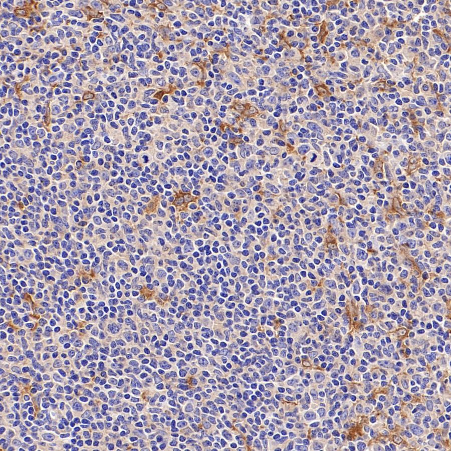 ATG7 Recombinant Rabbit mAb (S-1279-201)
