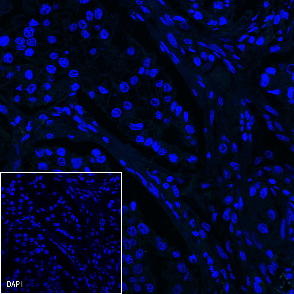S-RMab® ErbB2 Recombinant Rabbit mAb (SDT-069-57)