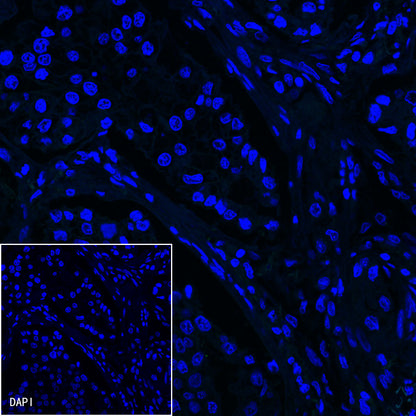 S-RMab® ErbB2 Recombinant Rabbit mAb (SDT-069-57)