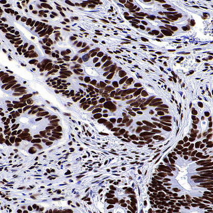 RBBP4 Rabbit Polyclonal Antibody