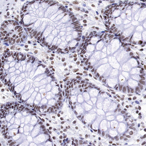 PIAS1 Recombinant Rabbit mAb (S-1430-7)