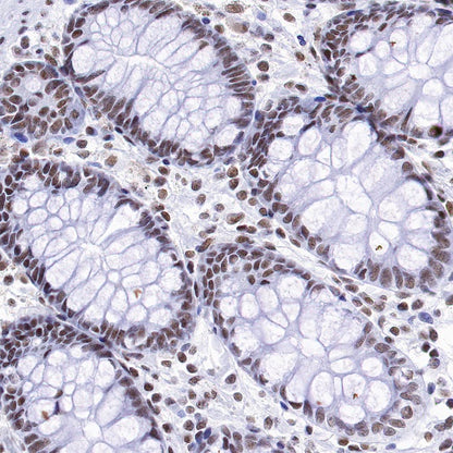 PIAS1 Recombinant Rabbit mAb (S-1430-7)