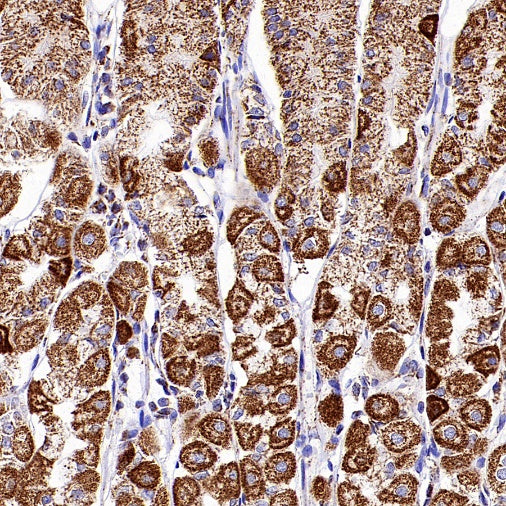 HADHA Recombinant Rabbit mAb (S-2345-8)
