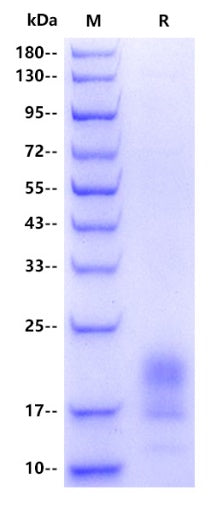 Human CD151 Protein, His tag