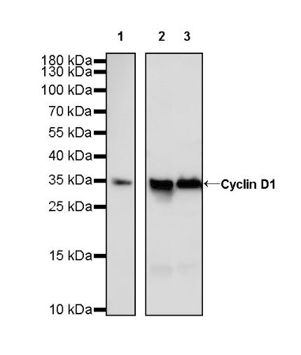 Cyclin D1 Recombinant Rabbit mAb (SDT-R423)