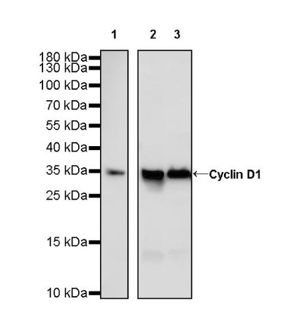 Cyclin D1 Recombinant Rabbit mAb (SDT-R423)