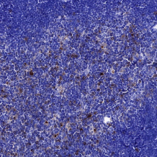 Rabbit Anti-Mouse CD137 Antibody (S-547-3)