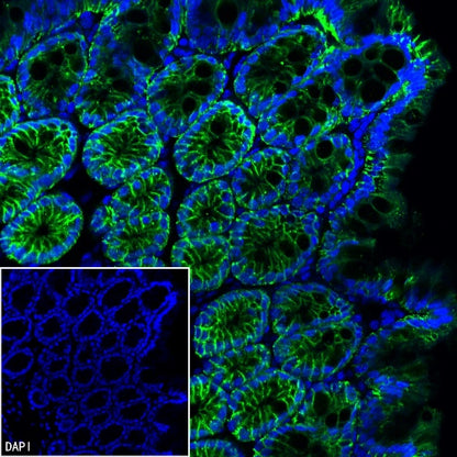 TROP1/EPCAM Recombinant Rabbit mAb (S-1379-5)