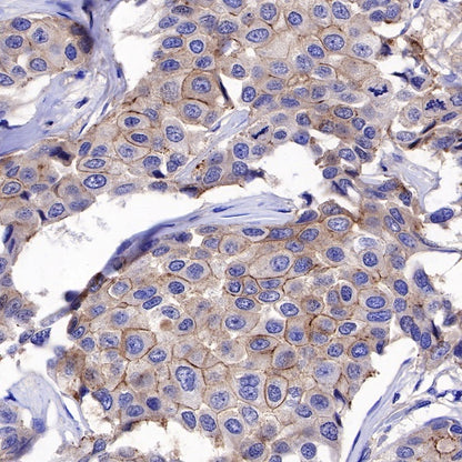 E-Cadherin Recombinant Rabbit mAb (SDT-438-45)
