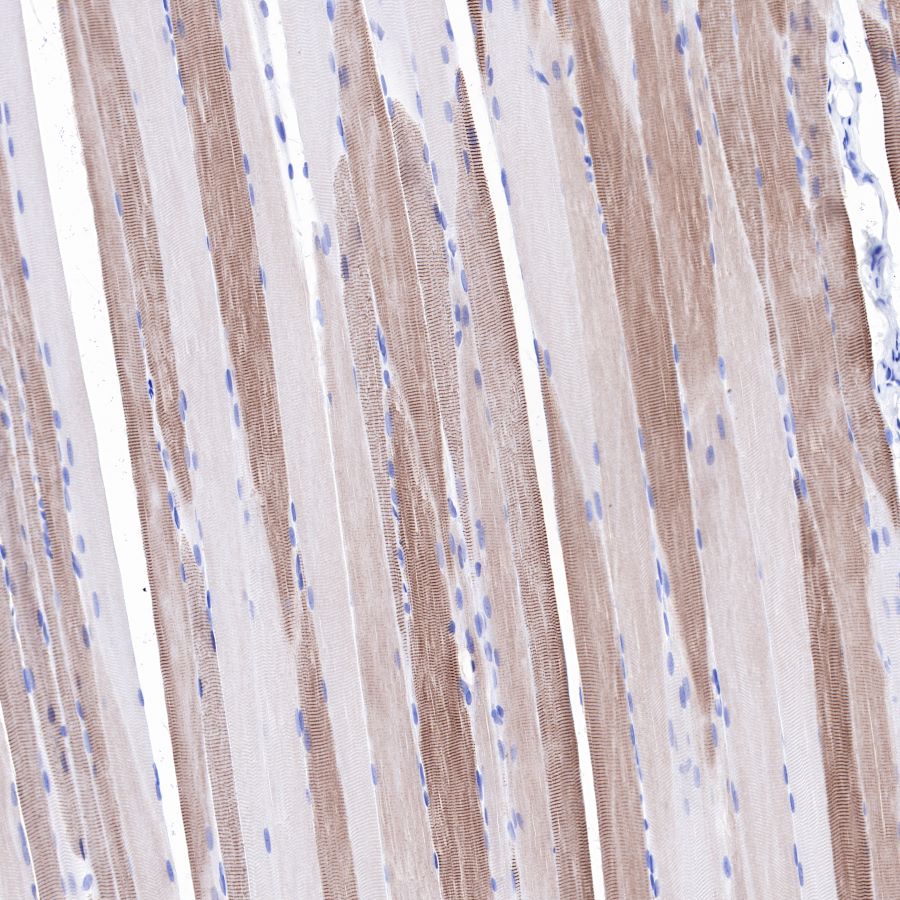 alpha-actinin-2 Recombinant Rabbit mAb (SDT-032-79)