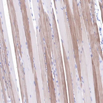 alpha-actinin-2 Recombinant Rabbit mAb (SDT-032-79)