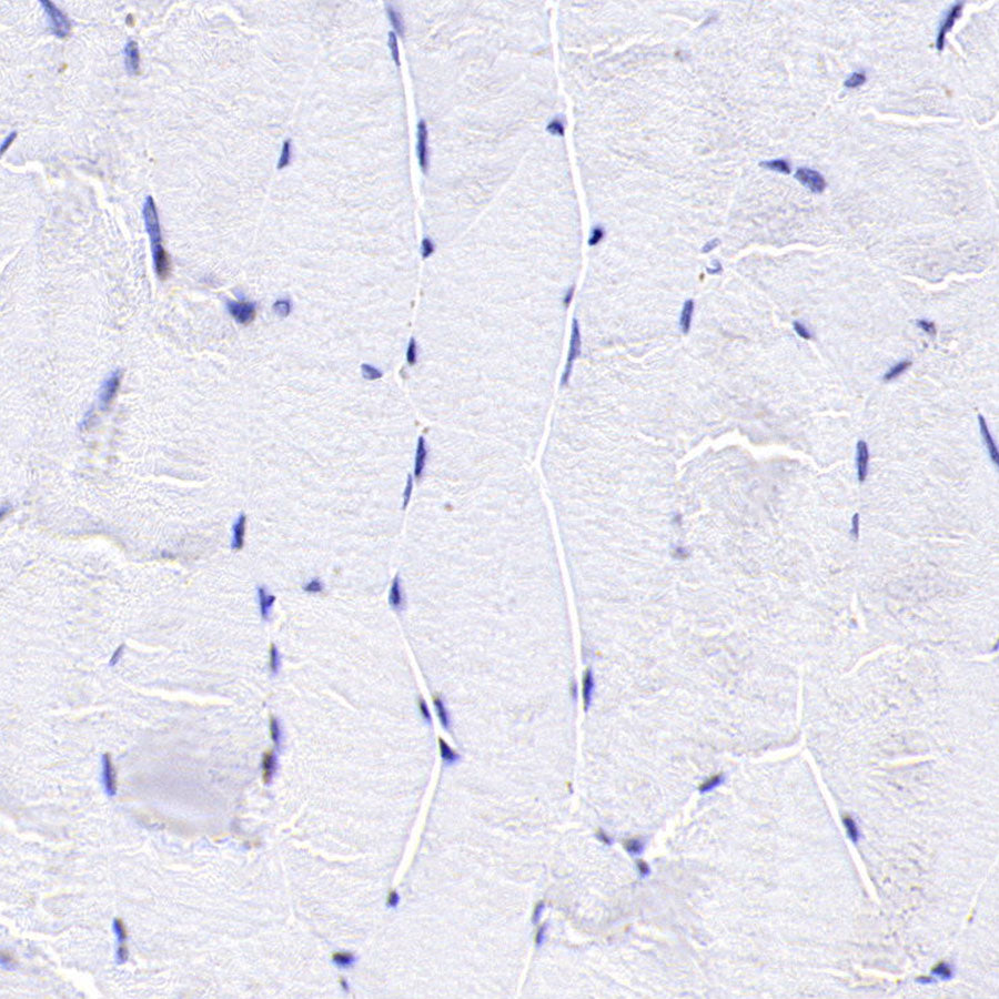 NNMT Recombinant Rabbit mAb (S-3470-58)