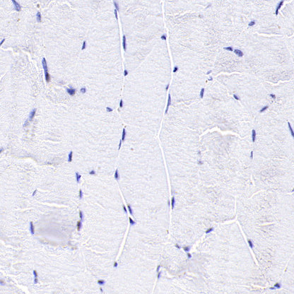 NNMT Recombinant Rabbit mAb (S-3470-58)