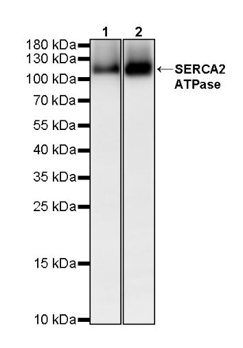 SERCA2 ATPase Recombinant Rabbit mAb (S-5956)