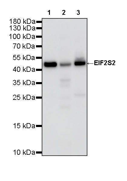 EIF2S2 Rabbit Polyclonal Antibody