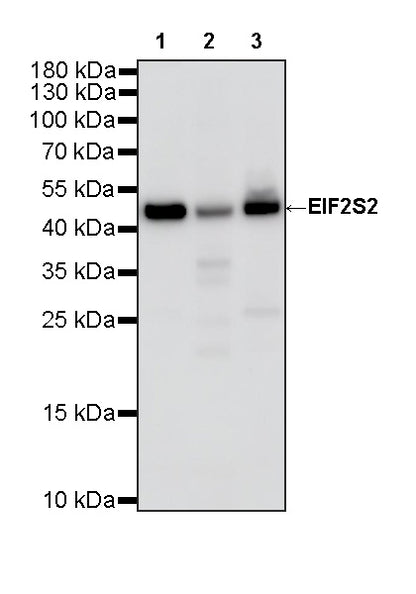 EIF2S2 Rabbit Polyclonal Antibody