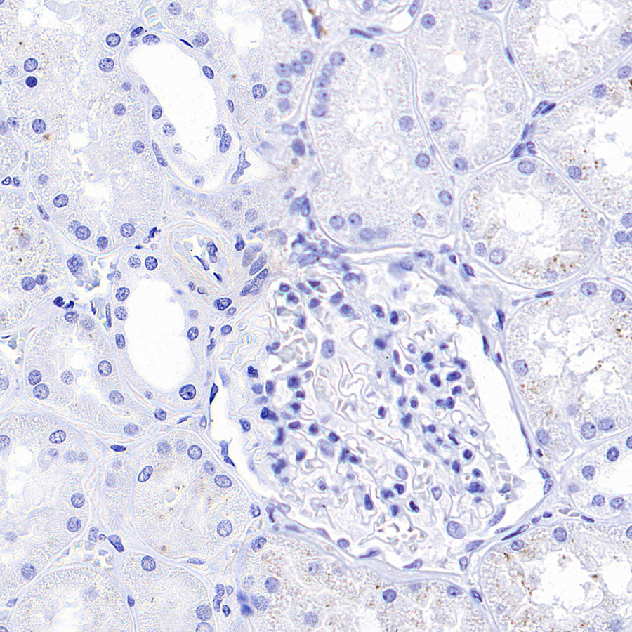 SV2A Recombinant Rabbit mAb (S-4049-16)