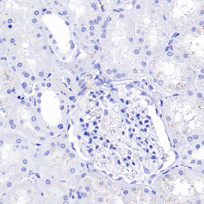 SV2A Recombinant Rabbit mAb (S-4049-16)