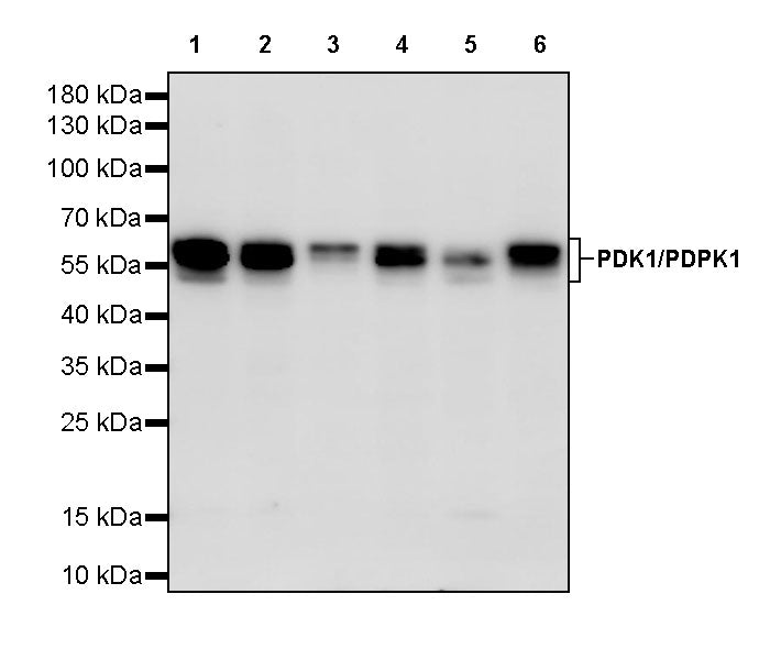 PDK1/PDPK1 Recombinant Rabbit mAb (S-3050-116)