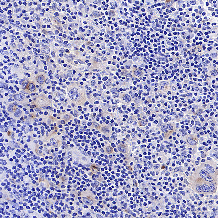 4-1BB/CD137/TNFRSF9 Recombinant Rabbit mAb (S-4989)