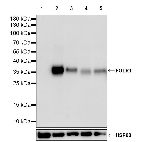 FOLR1 Recombinant Rabbit mAb (SDT-3635-124)