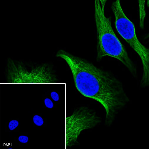 β-tubulin Recombinant Rabbit mAb (SDT-312-113)