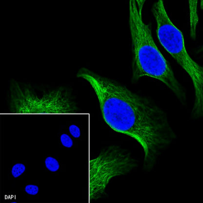 β-tubulin Recombinant Rabbit mAb (SDT-312-113)