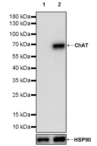 Choline Acetyltransferase/ChAT Recombinant Rabbit mAb (S-2561-17)