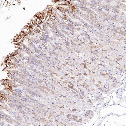 Integrin beta 6 Recombinant Rabbit mAb (SDT-1445-78)