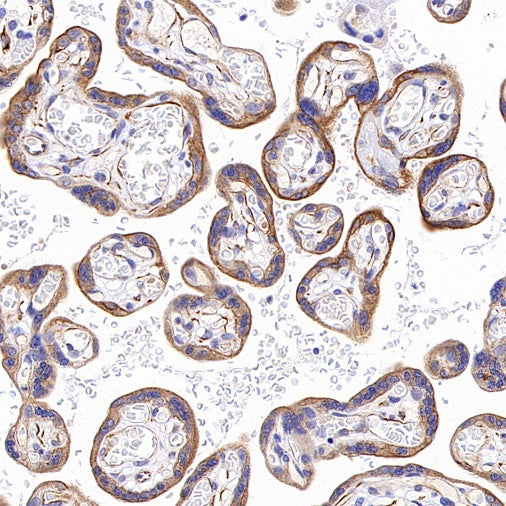 Phospho-Vimentin (Ser39) Rabbit Polyclonal Antibody