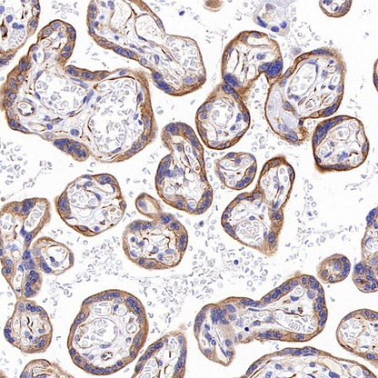 Phospho-Vimentin (Ser39) Rabbit Polyclonal Antibody