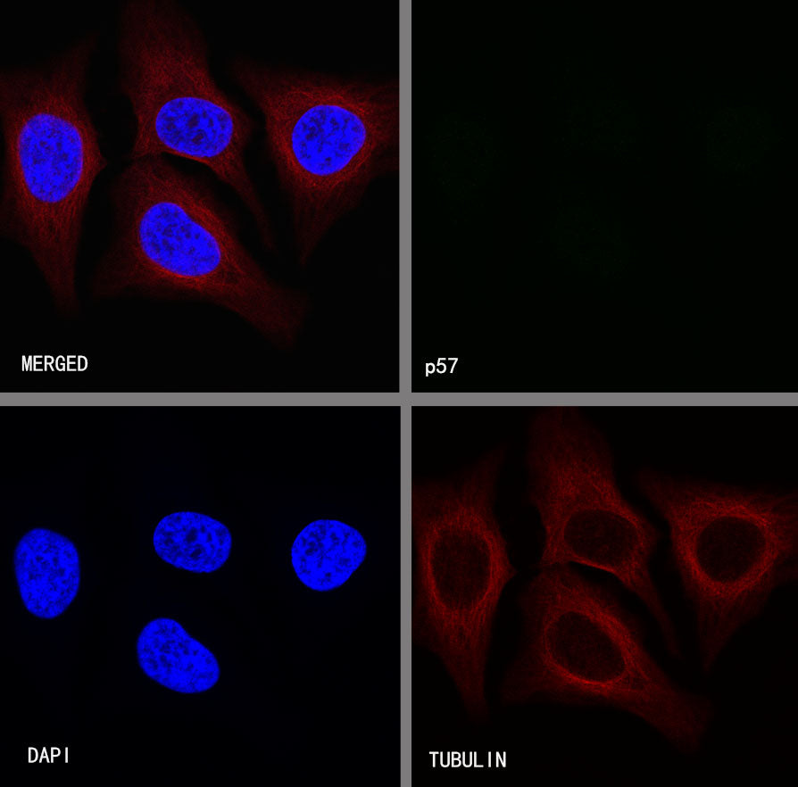 p57 Recombinant Rabbit mAb (SDT-191-79)