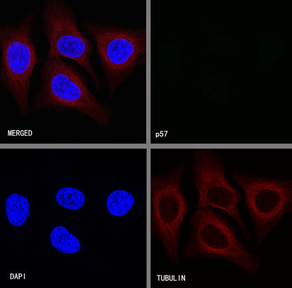 p57 Recombinant Rabbit mAb (SDT-191-79)