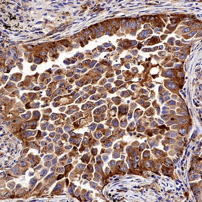 beta Galactosidase/GLB1 Recombinant Rabbit mAb (S-2295-7)