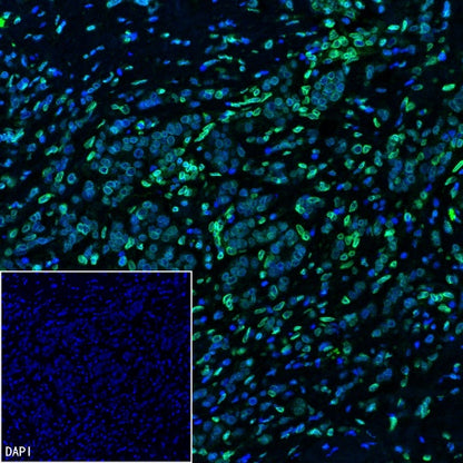 SREBP2 Recombinant Rabbit mAb (S-2701-1)
