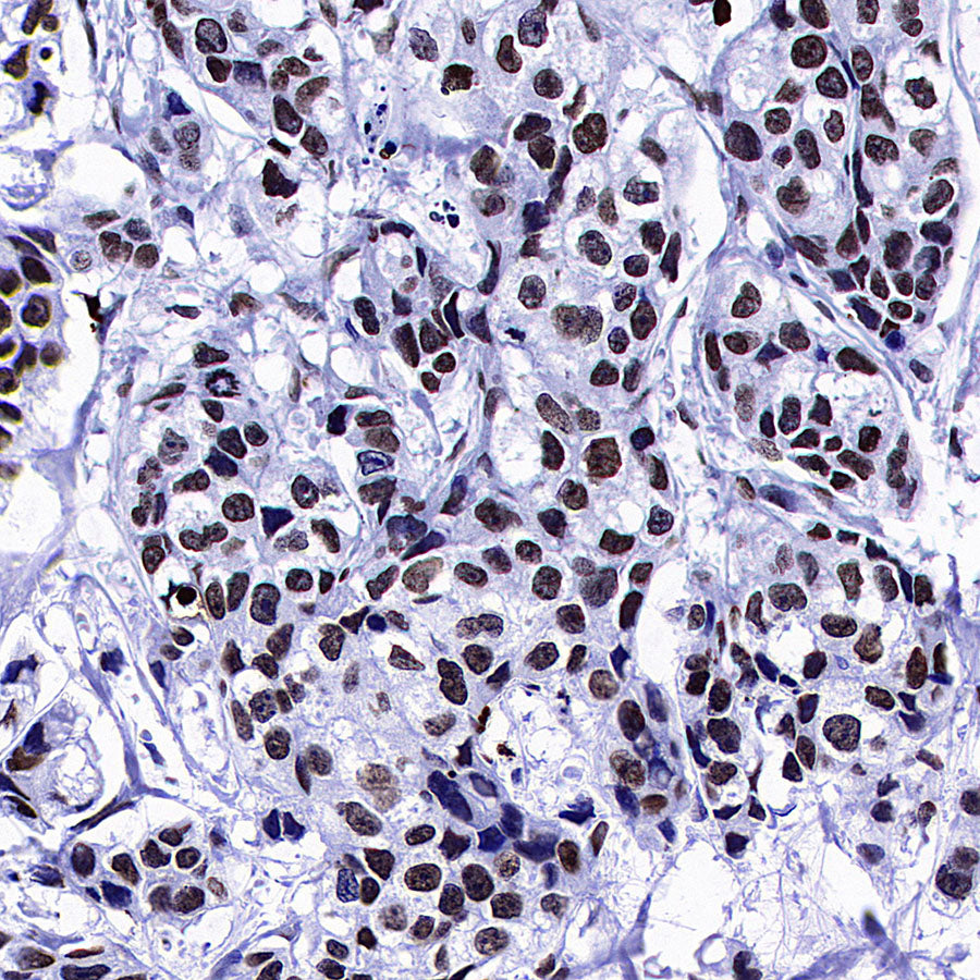 Histone H3 Recombinant Rabbit mAb (S-5672)